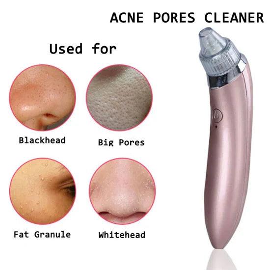 Face Vacuum Blackhead Remover Pore Cleaner Your Desire