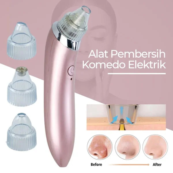 Face Vacuum Blackhead Remover Pore Cleaner Your Desire